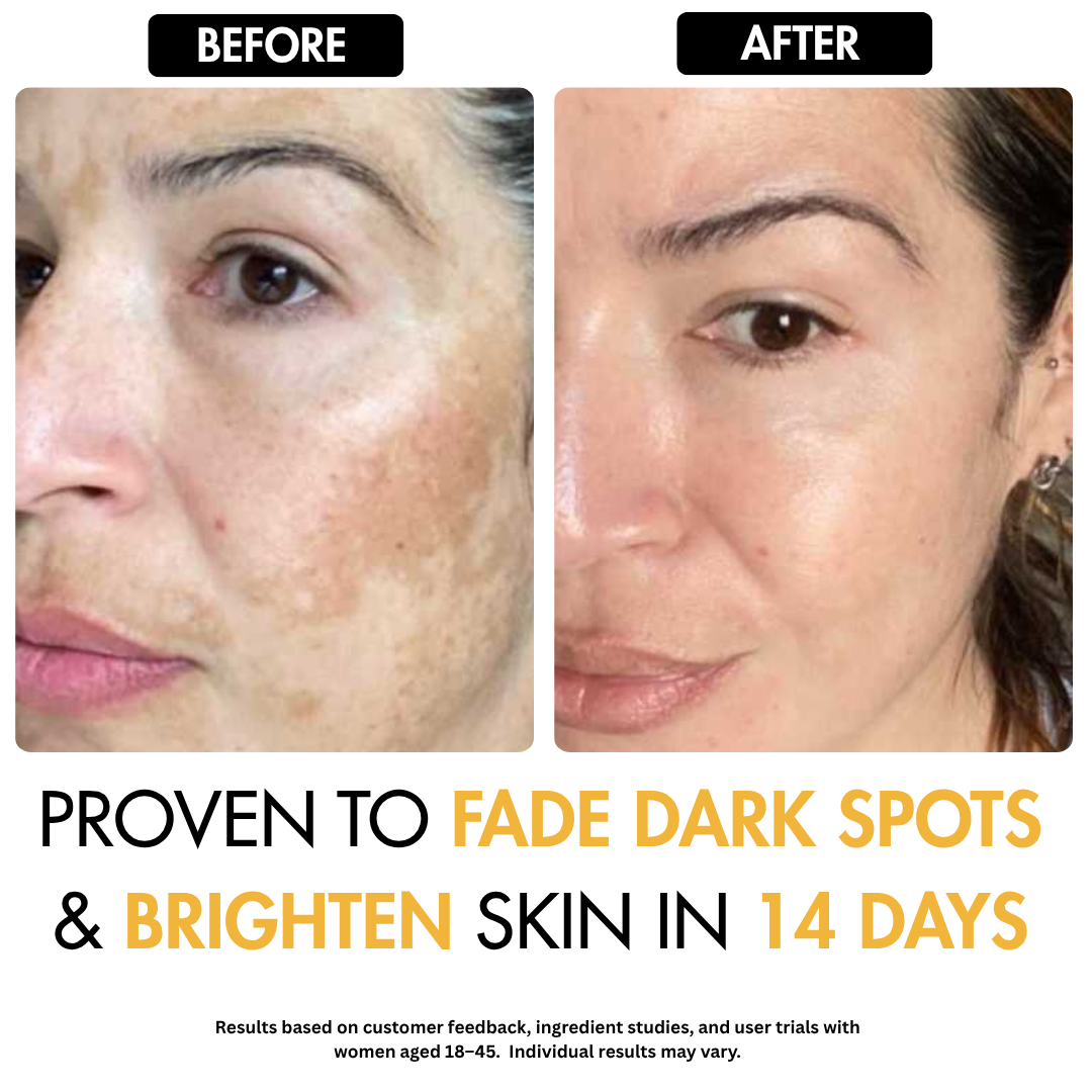 Turmeric Kojic Dark Spot Soap