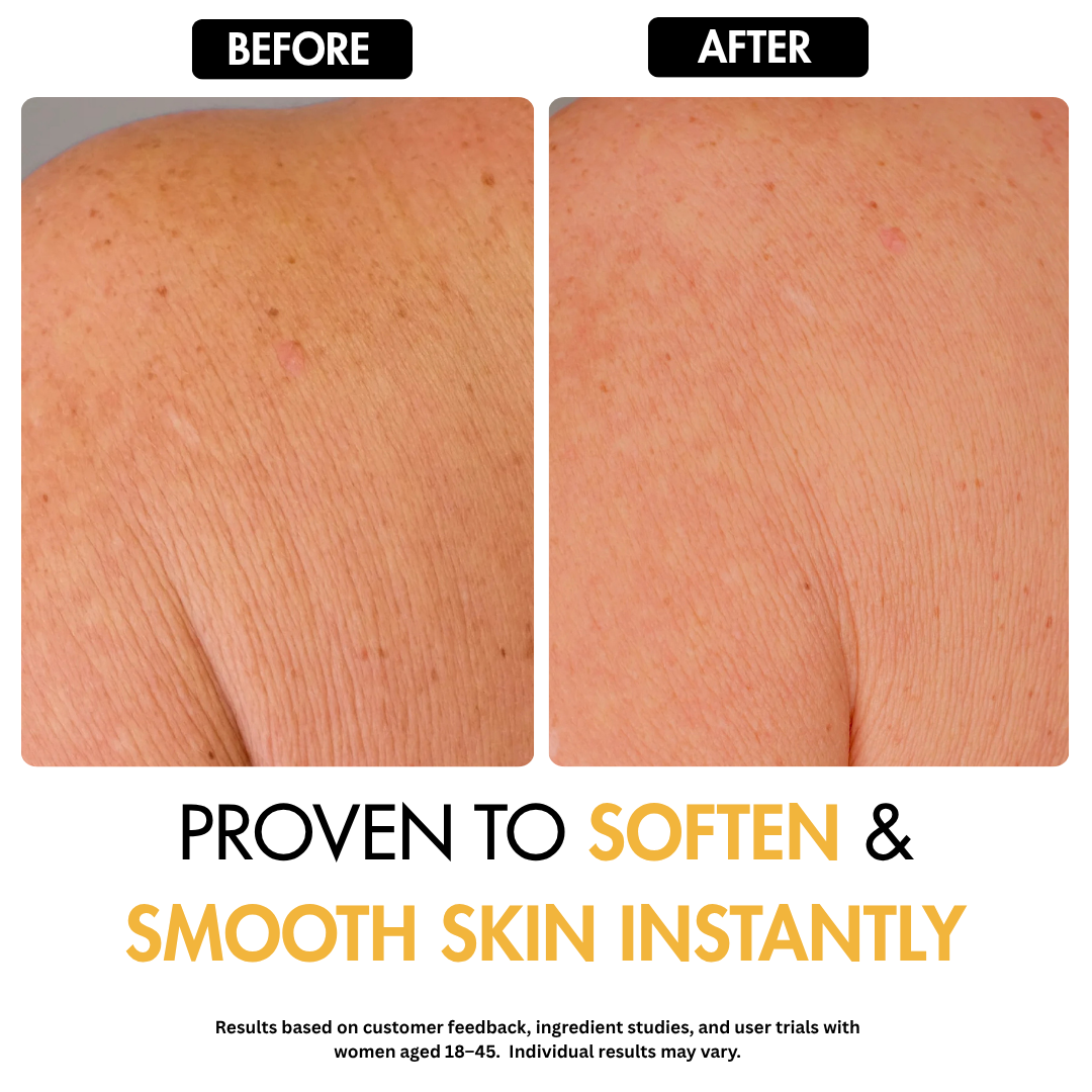 Turmeric Kojic Dark Spot Soap